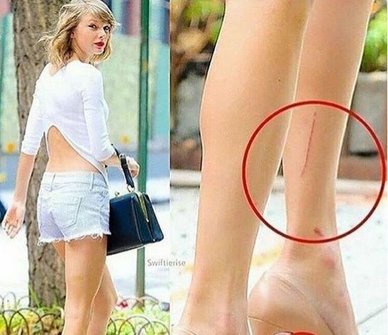 VIRAL! Betis Taylor Swift Lecet, Netizen Malah Ribut Itu Foto Asli atau Editan