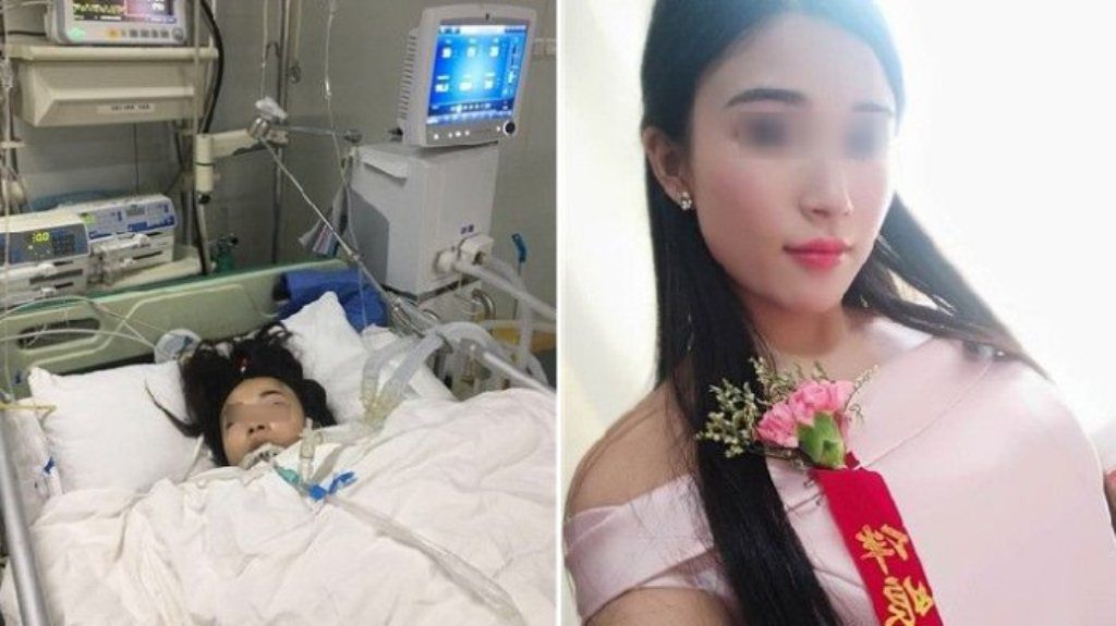 Jadi Bridesmaid di 2 Pernikahan, Nasib Wanita ini Berakhir Malang, Hampir Meninggal dan Kaki Diamputasi