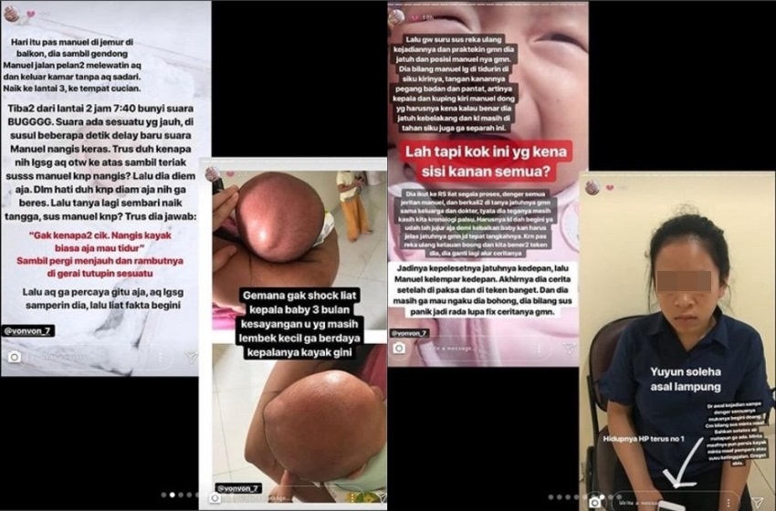 Akibat Ulah Babysitter Ceroboh, Bayi 3 Bulan Alami Hal Mengerikan, Curhatan Sang Ibu Viral