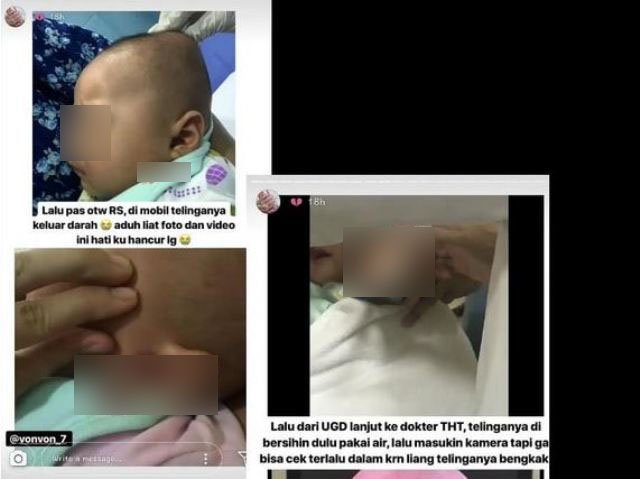 Kisah Tengkorak Kepala Bayi Retak Akibat Ulah Babysitter Viral di Medsos