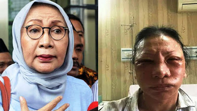 Astaghfirullah! Ratna Sarumpaet Dipukuli Banyak Orang Sampai Wajahnya Bonyok!