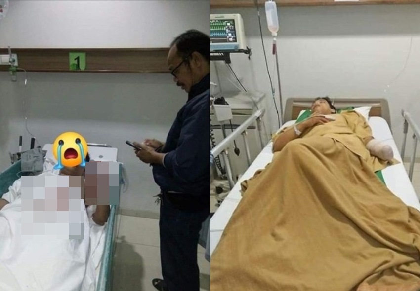 Sempat Dikira Korban Mutilasi, Kisah Pilu Mahasiswa yang Tangannya Ditebas Begal ini Viral