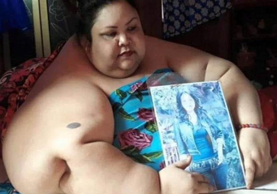 Viral Wanita Berusia 37 Tahun Milik Berat Badan Hingga 300 Kilogram