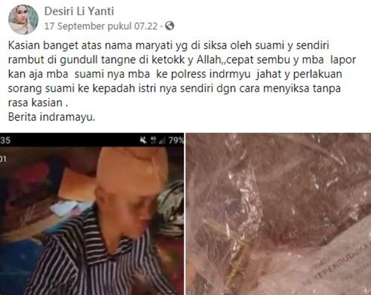 Viral Istri Digunduli dan Jarinya Putus, Korban Lapor Polisi