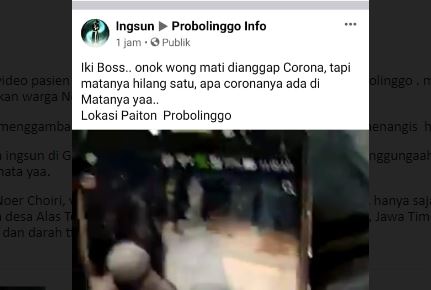 Heboh Pasien Covid-19 Matanya Hilang Satu, Berikut Faktanya