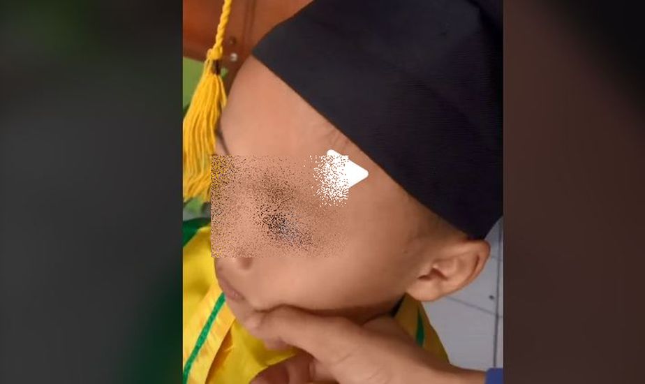 Viral Bocah Korban Broken Home Sedih Lihat Temannya Foto Wisuda Bareng Orangtua