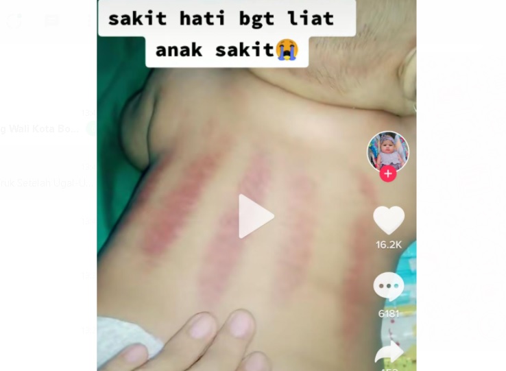 Viral! Ibu Ini Bawa Bayinya yang Sakit ke Dukun karena Takut Corona