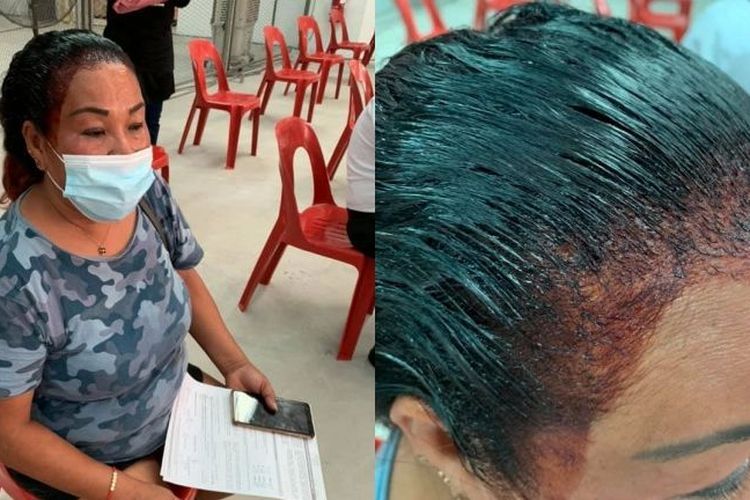 Viral Ibu-Ibu Bikin Heboh Lokasi Vaksinasi Gegara Semir Rambutnya Belum Kering