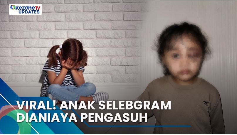 Viral Anak Selebgram Dianiaya Pengasuh Hingga Babak Belur, Selengkapnya di Okezone Updates Hari Ini!